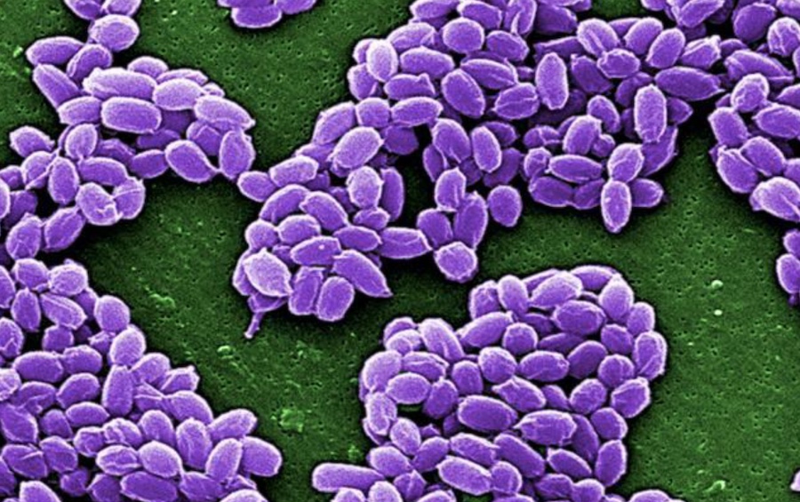Anthrax - image du Centers for Disease Control and Prevention (CDC)